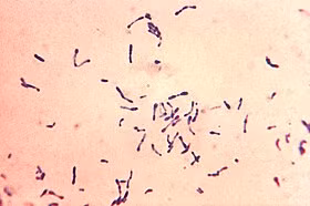 Bệnh bạch hầu do vi khuẩn Corynebacteria diphtheriae gây ra. Ảnh: Wikipedia. Dau hieu nhan biet som benh bach hau nguy hiem