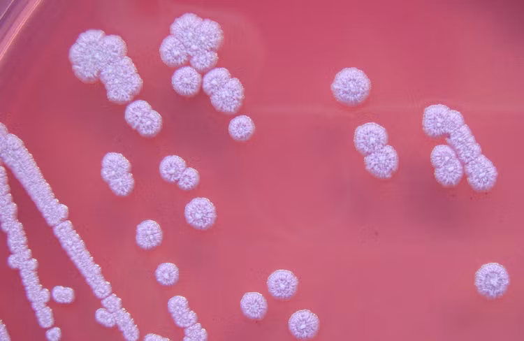Ai có nguy cơ mắc bệnh Whitmore cao hơn? Vi khuẩn Burkholderia pseudomallei gây bệnh Whitmore có thể làm hoại tử và chết các mô trong cơ thể. Ảnh: Wikipedia.