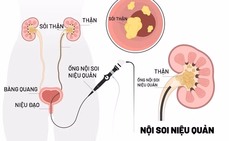 noi-soi-tan-soi-3191.jpg