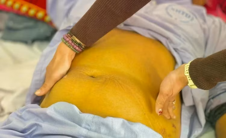 Lòng trắng mắt chuyển vàng, nước tiểu sẫm màu hay phân bạc màu có thể là dấu hiệu bệnh gan hoặc tắc đường mật, cần được kiểm tra sớm. Ảnh: BVCC.