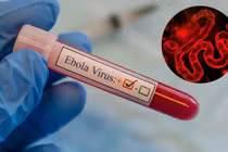 Bộ Y tế cảnh báo phòng chống bệnh do virus Ebola tại Việt Nam
