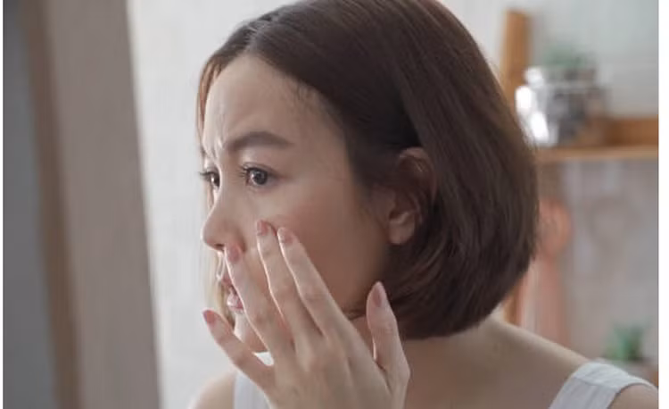 Bác sĩ chỉ rõ 4 triệu chứng bất thường trên mặt cần đi khám ngay ảnh 1 Bác sĩ chỉ rõ 4 triệu chứng bất thường trên mặt cần đi khám ngay ảnh 1
