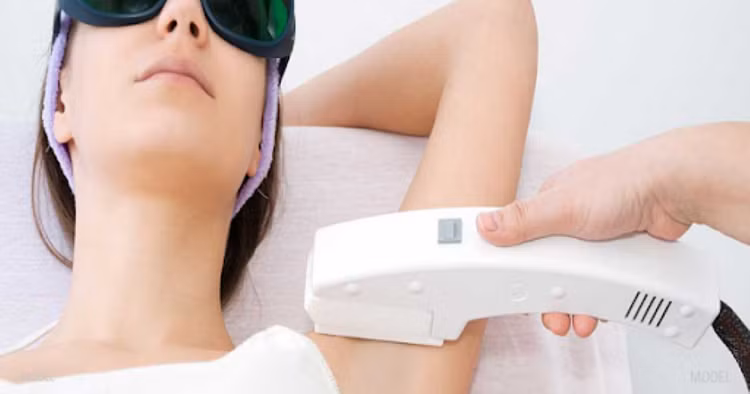 Điều cần biết khi triệt lông bằng laser ảnh 1