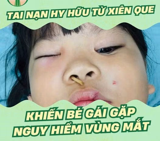 Ảnh BVCC Ảnh BVCC