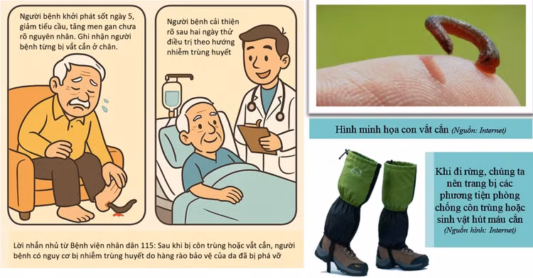 Đi rừng bị “vết cắn nhỏ” người đàn ông suýt tử vong vì nhiễm trùng huyết - Hình minh họa BVCC Đi rừng bị “vết cắn nhỏ” người đàn ông suýt tử vong vì nhiễm trùng huyết - Hình minh họa BVCC
