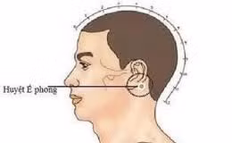 Vị trí huyệt Ế Phong - Ảnh BSCC Vị trí huyệt Ế Phong - Ảnh BSCC