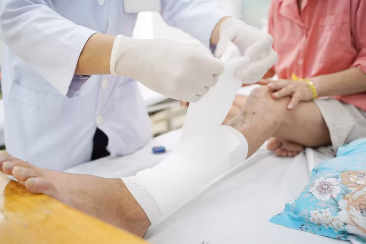 Bệnh nhân bị tổn gãy hở hai xương cẳng chân trái và khuyết hổng mô mềm mức độ nặng - Ảnh BVCC