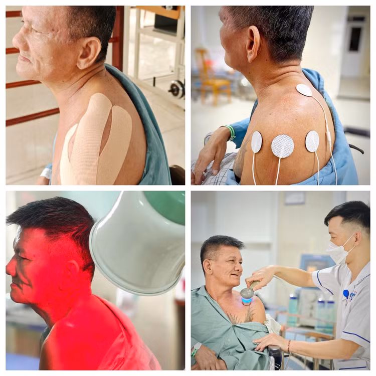 Vai người bệnh đã phục hồi tốt sau 3 tháng tập phục hồi chức năng - Ảnh BVCC