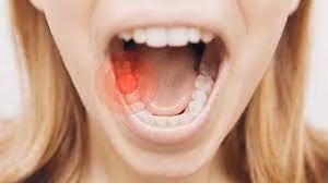 Bác sĩ mách cách phòng ngừa 1 số bệnh về răng miệng thường gặp ảnh 1