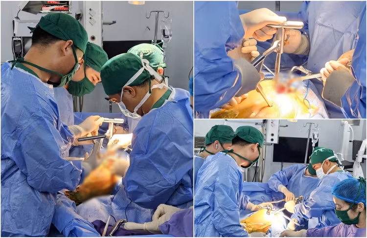 Kíp bác sĩ khoa Chấn thương chỉnh hình thực hiện thay khớp háng nhân tạo bằng kỹ thuật SuperPath cho bệnh nhân T. - Ảnh BVCC