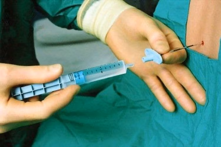 Giảm đau ngoài màng cứng điều trị viêm tụy cấp ảnh 1