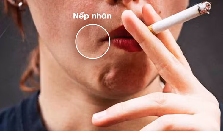 Hút thuốc lá nguy cơ ung thư da cao hơn 52% ảnh 1