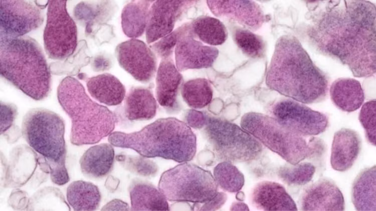 Vi khuẩn Mycoplasma gây ra nhiều bệnh khác nhau - Ảnh minh họa Vi khuẩn Mycoplasma gây ra nhiều bệnh khác nhau - Ảnh minh họa