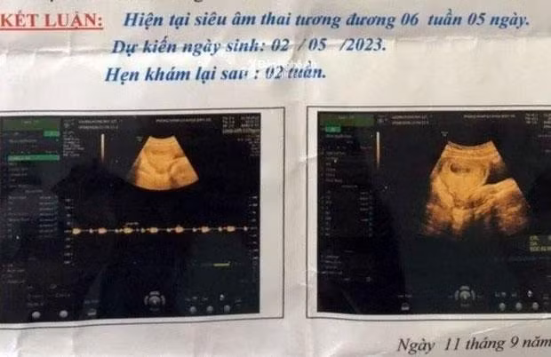 Hình ảnh siêu âm bé gái có bầu