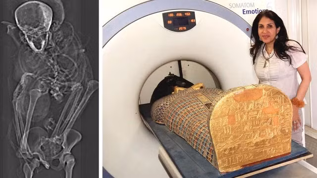Pharaoh Seqenenre Tao II nổi tiếng lịch sử với vai trò lãnh đạo quân đội Ai Cập chống lại Hyksos - vương triều có nguồn gốc Tây Á ôm mưu đồ đánh chiếm và kiểm soát vùng đồng bằng sông Nile. New Study on Pharaoh Seqenenre Tao II, by my friend, Dr. Sahar Saleem. On the battlefield with the Hyksos, he was bound with his hands tied behind his back and attacked by