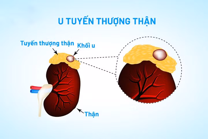Ảnh BVCC Ảnh BVCC