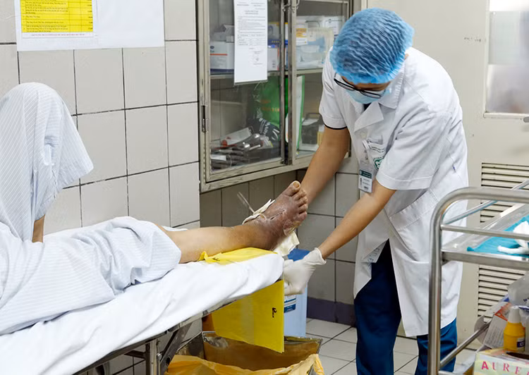 Chăm sóc bàn chân cho bệnh nhân đái tháo đường - Ảnh BVCC