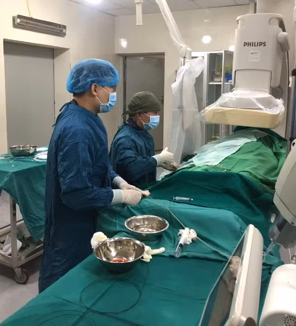 Bác sĩ thực hiện nút mạch lách trên bệnh nhân - Ảnh BSCC Bác sĩ thực hiện nút mạch lách trên bệnh nhân - Ảnh BSCC