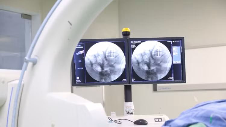 Bác sĩ đang trực tiếp đốt sóng cao tần xung cho người bệnh