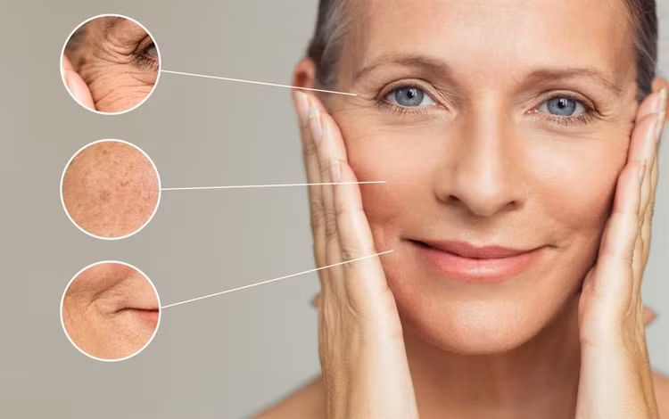 Tránh các biểu hiện trên khuôn mặt lặp đi lặp lại để chống nếp nhăn