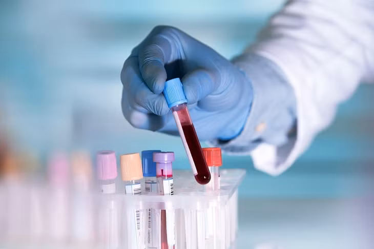 7 xét nghiệm máu không cần nhịn ăn - Ảnh minh hoạ