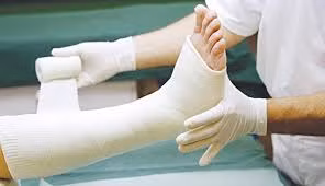Bác sĩ mách cách theo dõi bó bột tránh biến chứng nguy hiểm - Ảnh minh họa
