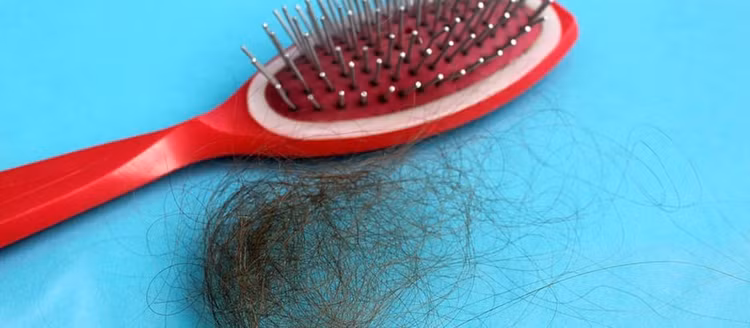 Rụng tóc do bệnh tuyến giáp - Ảnh minh họa