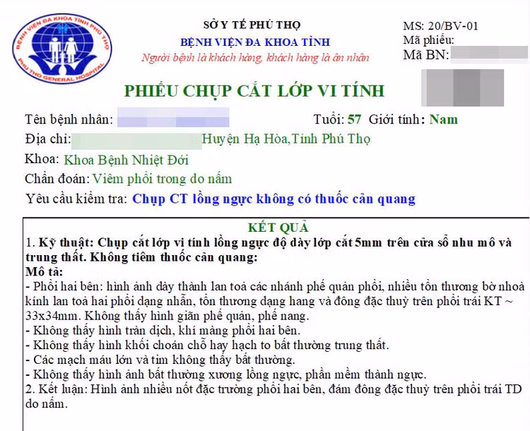 Kết quả chụp cắt lớp vi tính của người bệnh - Ảnh BVCC Kết quả chụp cắt lớp vi tính của người bệnh - Ảnh BVCC