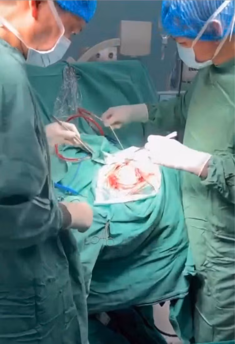 4 giờ đồng hồ căng thẳng phẫu thuật cho bệnh nhân - Ảnh BVCC 4 giờ đồng hồ căng thẳng phẫu thuật cho bệnh nhân - Ảnh BVCC