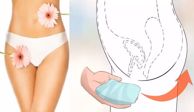 Quần chip bỗng nhiên có đặc điểm bất thường cẩn thận viêm phụ khoa gõ cửa - Ảnh minh họa