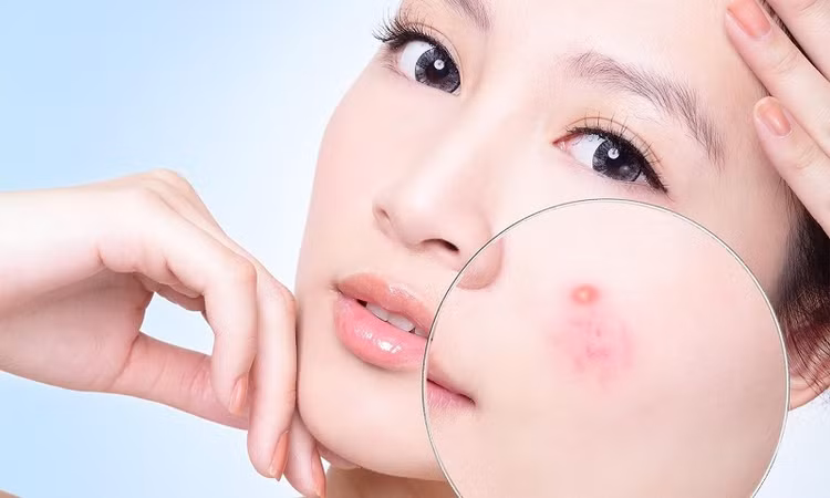 Loại bỏ sai lầm để da khỏe đẹp khi hè về ảnh 1