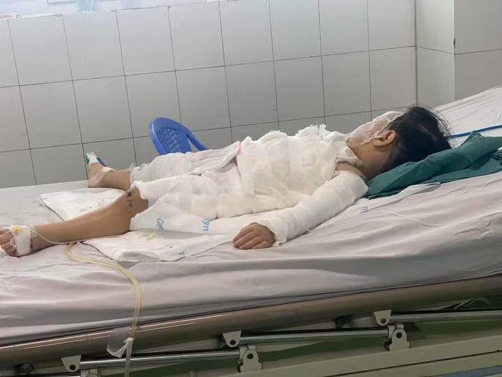 Tưởng chai nước ngọt bé 2 tuổi uống phải nước tẩy bồn cầu bỏng nặng Tưởng chai nước ngọt bé 2 tuổi uống phải nước tẩy bồn cầu bỏng nặng