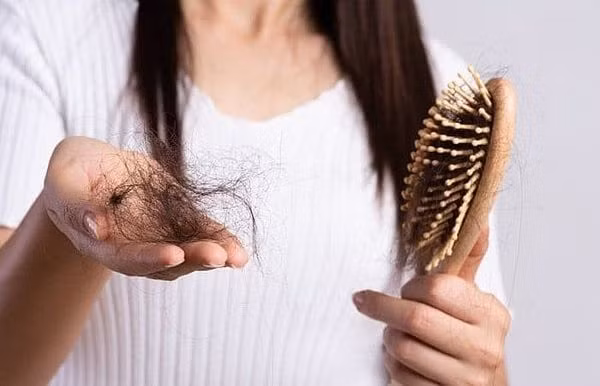 Rụng tóc quá mức có thể liên quan đến bệnh lý - Ảnh minh họa BVCC