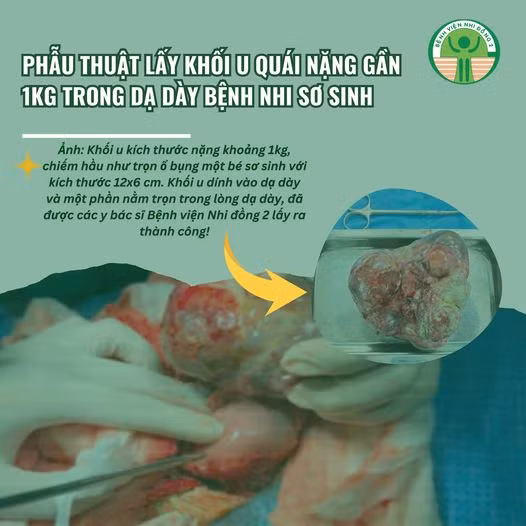 Ảnh BVCC
