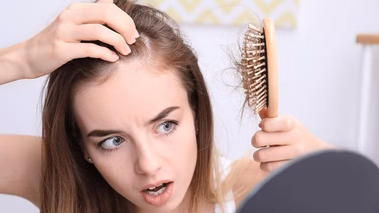 Rụng tóc không có sẹo Rụng tóc không có sẹo