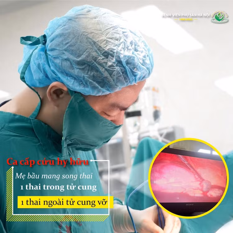 Ca phẫu thuật cho bà mẹ mang song thai - Ảnh BVCC Ca phẫu thuật cho bà mẹ mang song thai - Ảnh BVCC