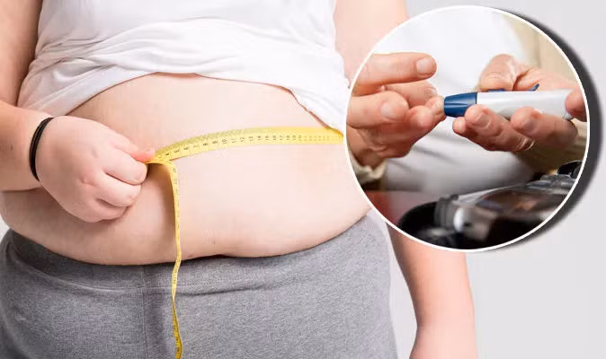Béo phì dẫn đến đái tháo đường type 2 ở người trẻ - Ảnh minh hoạ