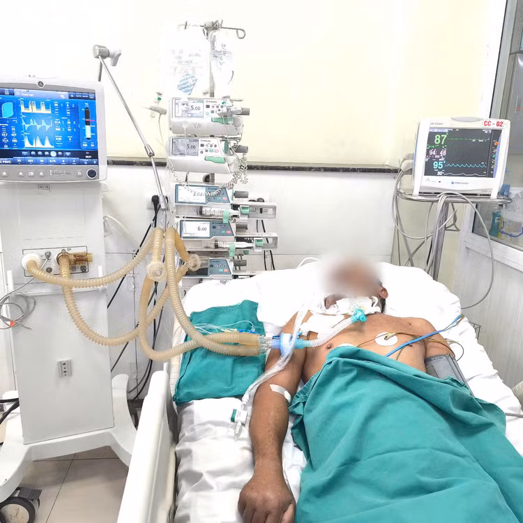 Người đàn ông nguy kịch vì uốn ván tân công - Ảnh BVCC Người đàn ông nguy kịch vì uốn ván tân công - Ảnh BVCC