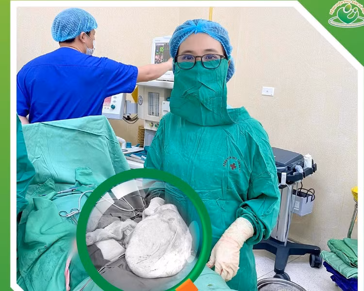 U nhầy buồng trứng nặng 8 kg ảnh 1