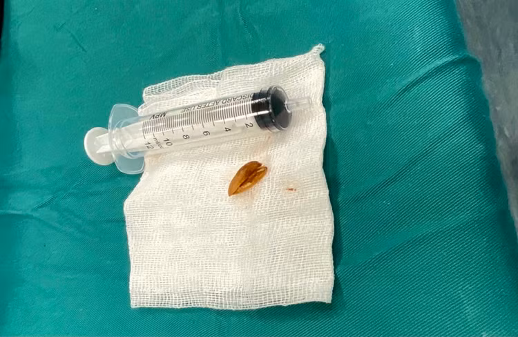 Vỏ hạt hướng dương được lấy ra