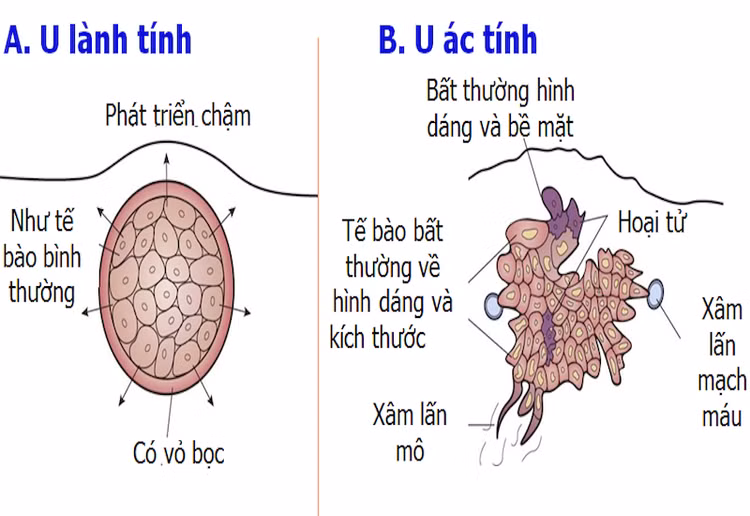 Ảnh minh họa Ảnh minh họa