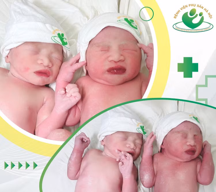 Hai trẻ sinh đôi tại bệnh viện Phụ sản Hà Nội - Ảnh BVCC