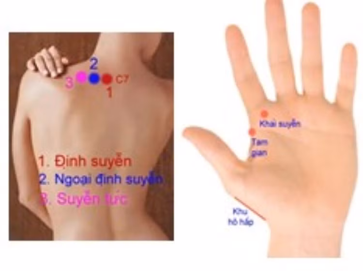 Các huyệt trị ho và hen suyễn - Ảnh BSCC Các huyệt trị ho và hen suyễn - Ảnh BSCC