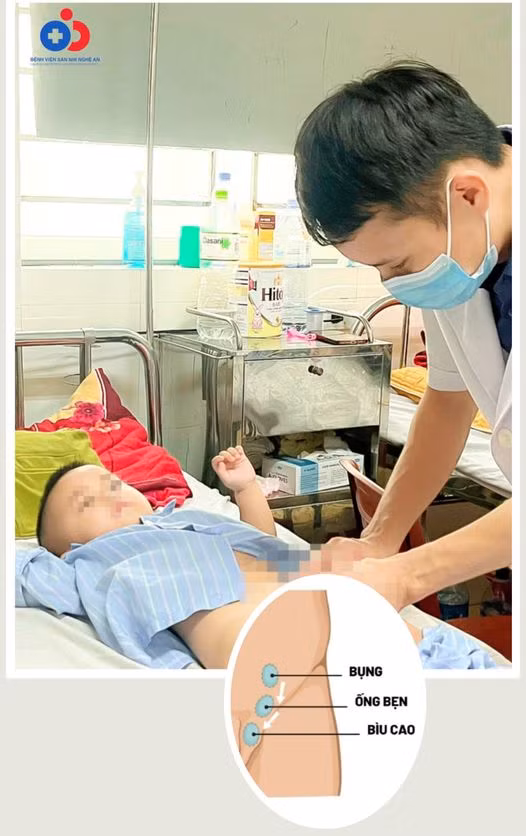 Thăm khám cho bệnh nhân sau phẫu thuật - Ảnh BVCC