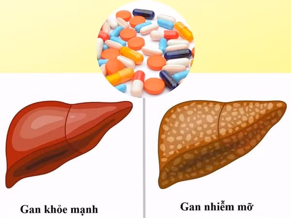 Địa chỉ vàng: Một số loại thực phẩm chức năng hỗ trợ gan nhiễm mỡ ảnh 1