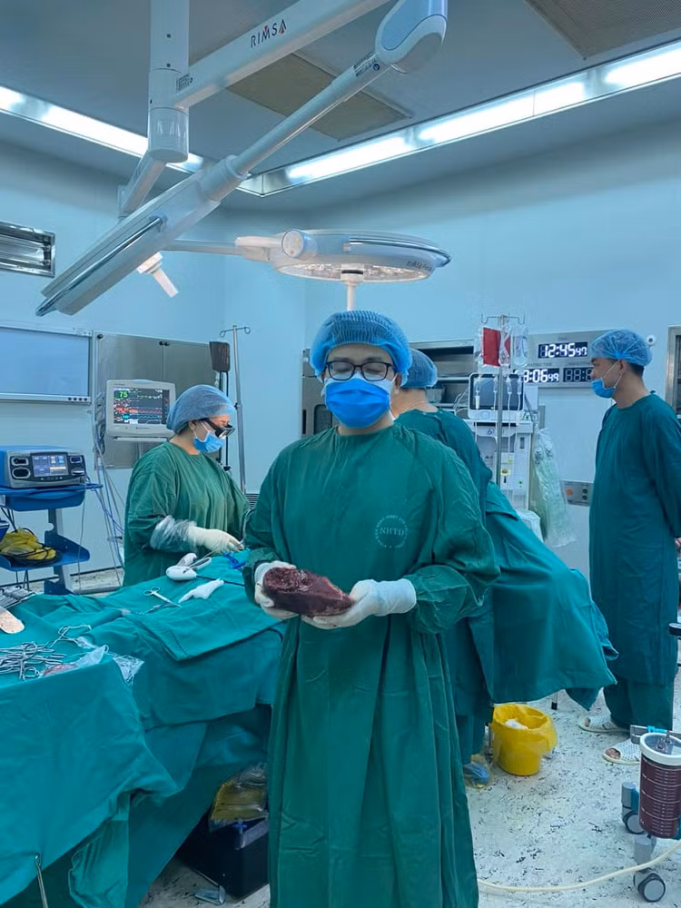Khối u gan được lấy ra - Ảnh BVCC Khối u gan được lấy ra - Ảnh BVCC