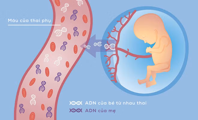 Sàng lọc và chẩn đoán trước sinh tránh sinh con dị tật Sàng lọc và chẩn đoán trước sinh tránh sinh con dị tật
