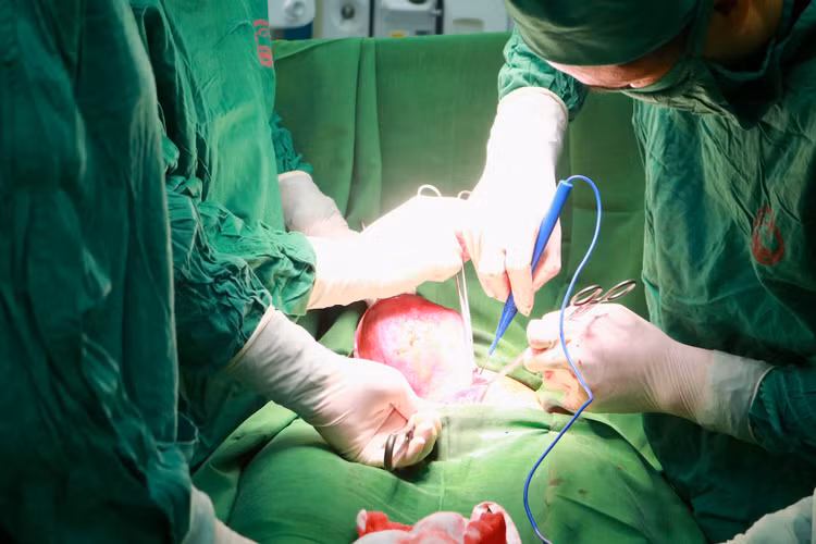 Ca phẫu thuật cho bệnh nhân - ảnh BVCC