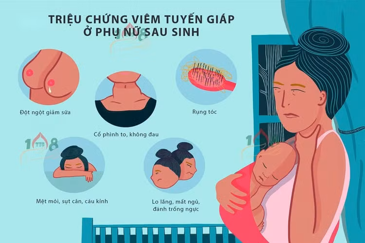Viêm tuyến giáp sau sinh dễ nhiễm độc, suy giáp - Ảnh minh họa BSCC Viêm tuyến giáp sau sinh dễ nhiễm độc, suy giáp - Ảnh minh họa BSCC