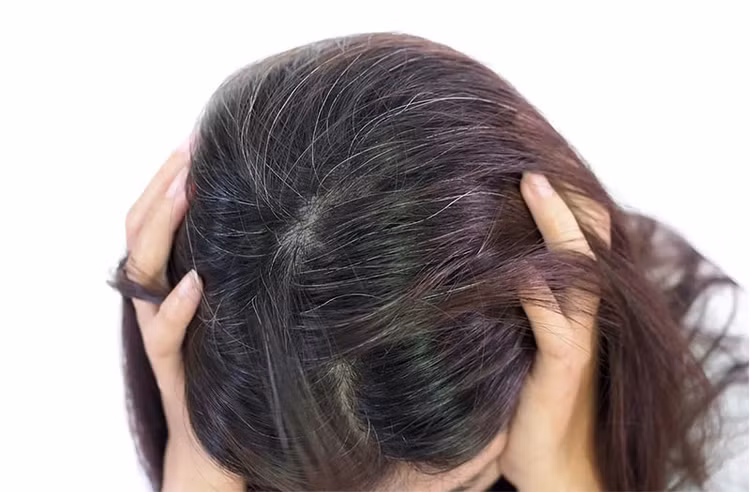 Bác sĩ giải thích cho việc tóc bạc sớm ở người trẻ ảnh 1